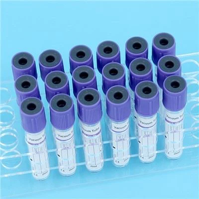 Skúmavka na odber krvi EDTAK2/K3 Vacutainer